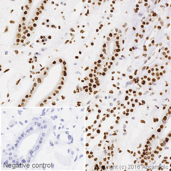 Immunohistochemistry (Formalin/PFA-fixed paraffin-embedded sections) - HRP Anti-ILF3 antibody [EPR3626] (AB206250)