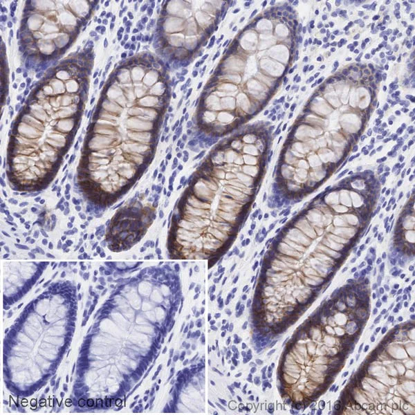 Immunohistochemistry (Formalin/PFA-fixed paraffin-embedded sections) - HRP Anti-Integrin alpha 2 antibody [EPR17338] - C-terminal (AB209944)