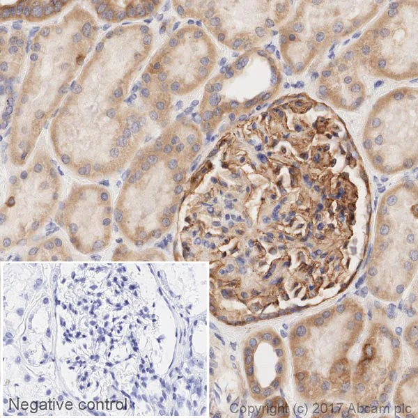Immunohistochemistry (Formalin/PFA-fixed paraffin-embedded sections) - HRP Anti-Integrin alpha V antibody [EPR16800] (AB205474)
