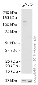 Western blot - HRP Anti-Integrin beta 1 antibody [EPR1040Y] (AB216295), expandable thumbnail