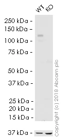 Western blot - HRP Anti-Integrin beta 1 antibody [EPR1040Y] (AB216295)
