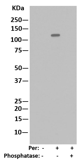 Western blot - HRP Anti-JAK1 (phospho Y1034 + Y1035) antibody [EPR1899(2)] (AB215338)