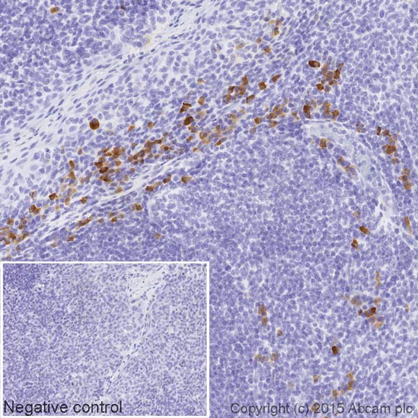 Immunohistochemistry (Formalin/PFA-fixed paraffin-embedded sections) - HRP Anti-Kappa light chain antibody [EPR5367-8] (AB202549)