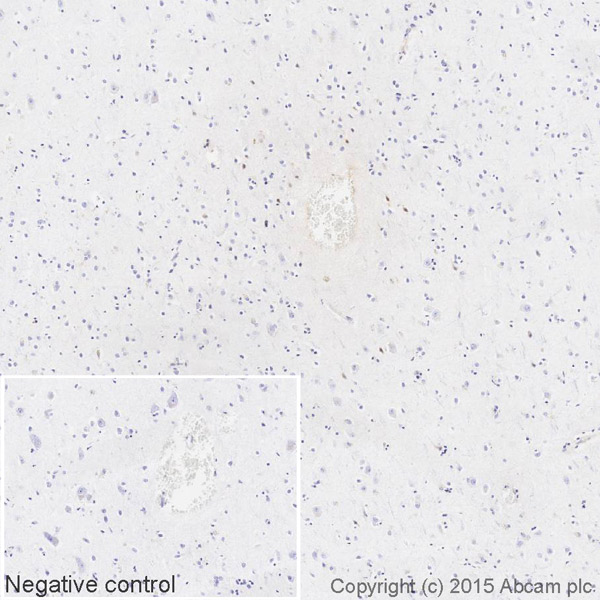 Immunohistochemistry (Formalin/PFA-fixed paraffin-embedded sections) - HRP Anti-Kappa light chain antibody [EPR5367-8] (AB202549), expandable thumbnail