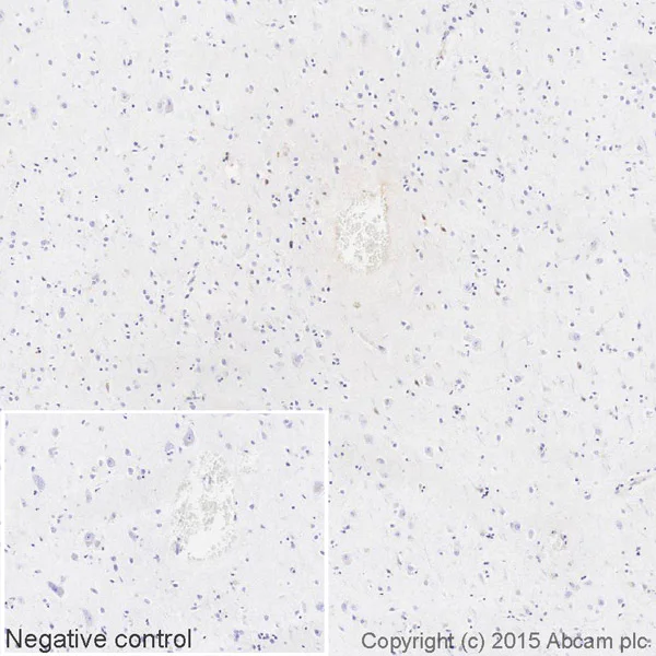 Immunohistochemistry (Formalin/PFA-fixed paraffin-embedded sections) - HRP Anti-Kappa light chain antibody [EPR5367-8] (AB202549)