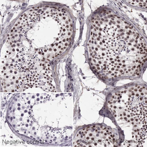 Immunohistochemistry (Formalin/PFA-fixed paraffin-embedded sections) - HRP Anti-KDM1/LSD1 antibody [EPR6825] - Nuclear Marker (AB195897)