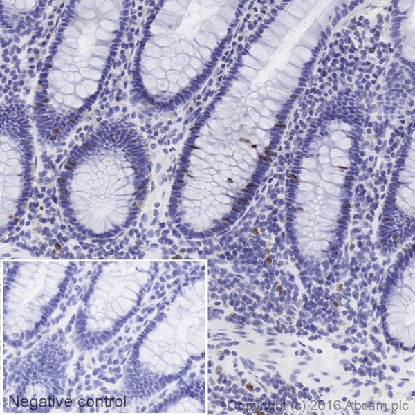 Immunohistochemistry (Formalin/PFA-fixed paraffin-embedded sections) - HRP Anti-Ki67 antibody [EPR3610] (AB212215), expandable thumbnail
