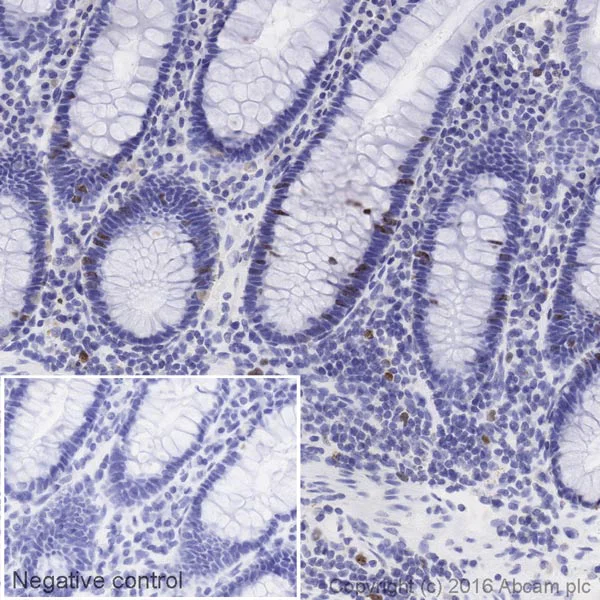 Immunohistochemistry (Formalin/PFA-fixed paraffin-embedded sections) - HRP Anti-Ki67 antibody [EPR3610] (AB212215)