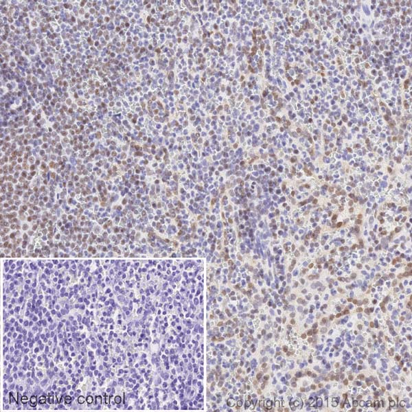 Immunohistochemistry (Formalin/PFA-fixed paraffin-embedded sections) - HRP Anti-Ku80 antibody [EPR3468] (AB199096), expandable thumbnail