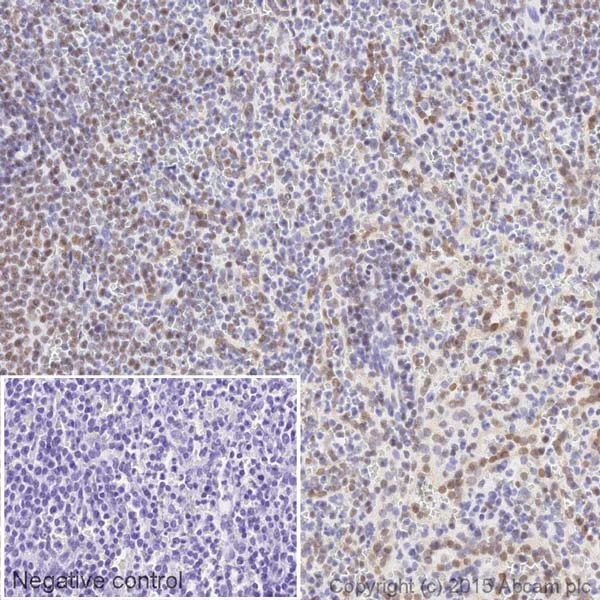 Immunohistochemistry (Formalin/PFA-fixed paraffin-embedded sections) - HRP Anti-Ku80 antibody [EPR3468] (AB199096)