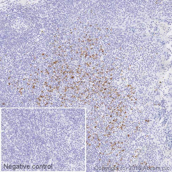 Immunohistochemistry (Formalin/PFA-fixed paraffin-embedded sections) - HRP Anti-Lambda Light chain antibody [EPR5367-62] (AB200966), expandable thumbnail