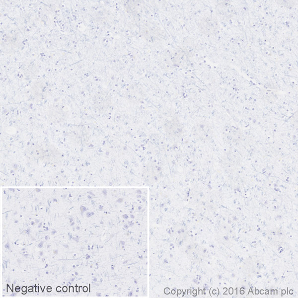 Immunohistochemistry (Formalin/PFA-fixed paraffin-embedded sections) - HRP Anti-Lambda Light chain antibody [EPR5367-62] (AB200966), expandable thumbnail