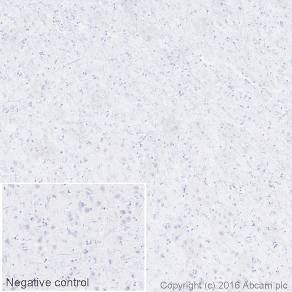 Immunohistochemistry (Formalin/PFA-fixed paraffin-embedded sections) - HRP Anti-Lambda Light chain antibody [EPR5367-62] (AB200966)