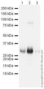 Western blot - HRP Anti-Lambda Light chain antibody [EPR5367-62] (AB200966), expandable thumbnail