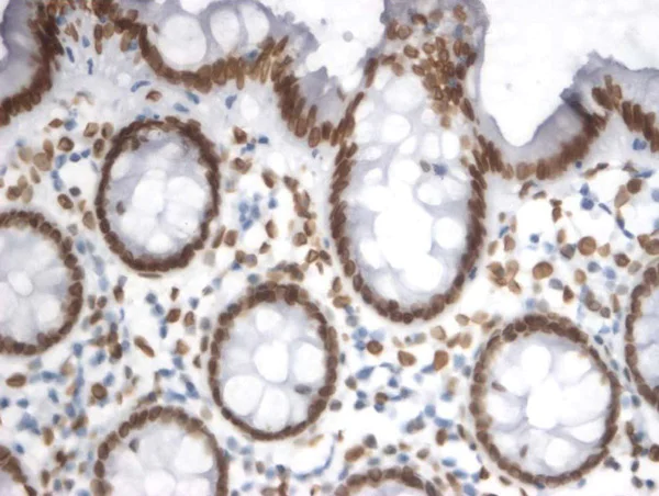 Immunohistochemistry (Formalin/PFA-fixed paraffin-embedded sections) - HRP Anti-Lamin A + Lamin C antibody [JOL2] (AB196636)