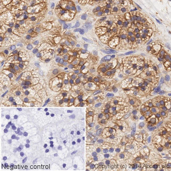 Immunohistochemistry (Formalin/PFA-fixed paraffin-embedded sections) - HRP Anti-LDL Receptor antibody [EP1553Y] (AB195516)