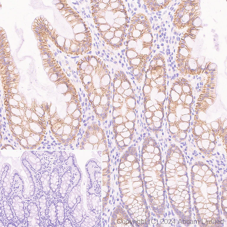 Immunohistochemistry (Formalin/PFA-fixed paraffin-embedded sections) - HRP Anti-LI Cadherin antibody [EPR3996] (AB323349)
