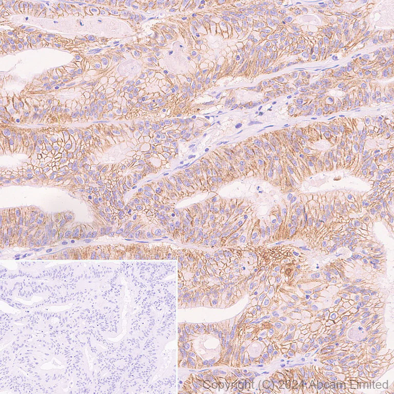 Immunohistochemistry (Formalin/PFA-fixed paraffin-embedded sections) - HRP Anti-LI Cadherin antibody [EPR3996] (AB323349)
