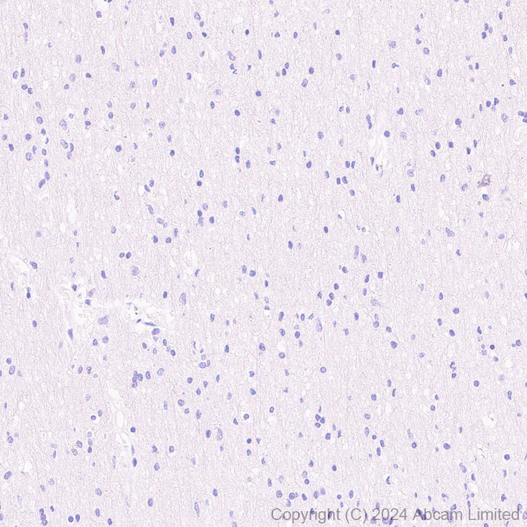 Immunohistochemistry (Formalin/PFA-fixed paraffin-embedded sections) - HRP Anti-LI Cadherin antibody [EPR3996] (AB323349)