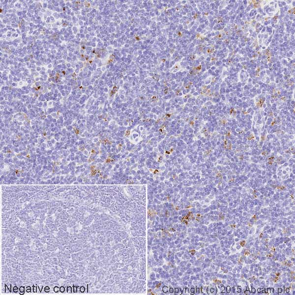 Immunohistochemistry (Formalin/PFA-fixed paraffin-embedded sections) - HRP Anti-Lysozyme antibody [EPR2994(2)] (AB197705)