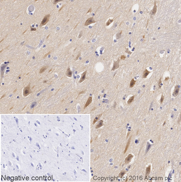Immunohistochemistry (Formalin/PFA-fixed paraffin-embedded sections) - HRP Anti-MAP1LC3A antibody [EP1528Y] (AB205439), expandable thumbnail