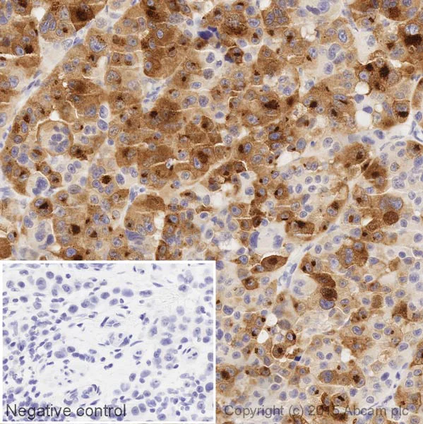 Immunohistochemistry (Formalin/PFA-fixed paraffin-embedded sections) - HRP Anti-Melanoma gp100 antibody [EP4863(2)] (AB205469)