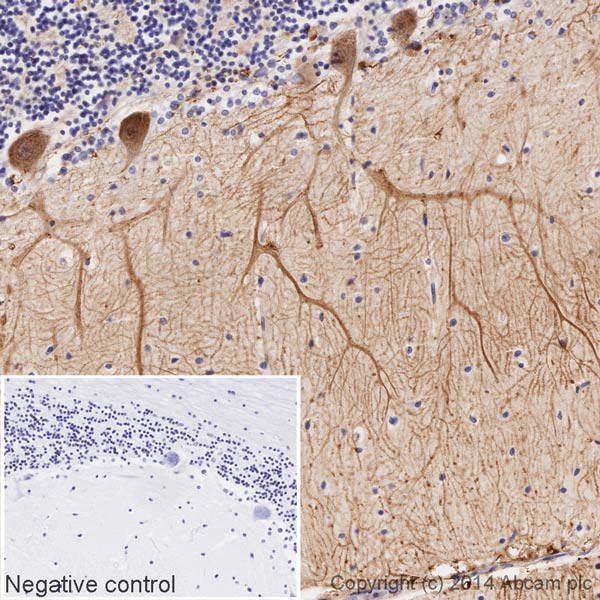 Immunohistochemistry (Formalin/PFA-fixed paraffin-embedded sections) - HRP Anti-Metabotropic Glutamate Receptor 5 antibody [EPR2425Y] (AB196482), expandable thumbnail