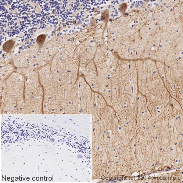 Immunohistochemistry (Formalin/PFA-fixed paraffin-embedded sections) - HRP Anti-Metabotropic Glutamate Receptor 5 antibody [EPR2425Y] (AB196482)