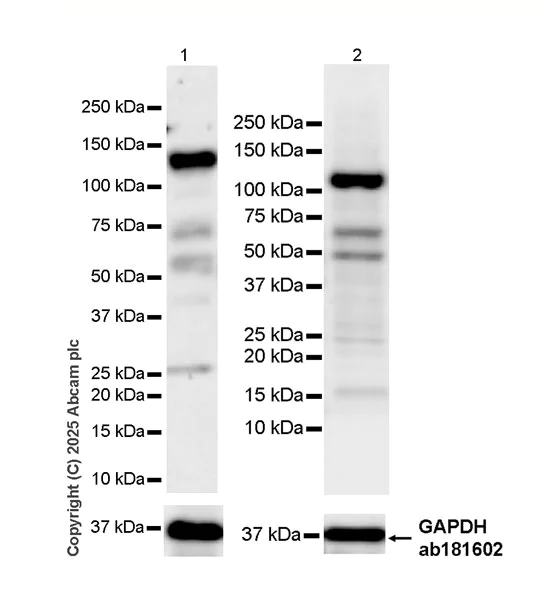 Western blot - HRP Anti-MGEA5/OGA antibody [EPR7154(B)] (AB323781)