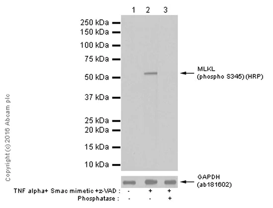 Western blot - HRP Anti-MLKL (phospho S345) antibody [EPR9515(2)] (AB208430)