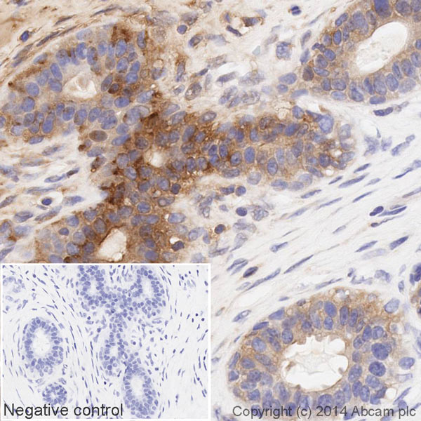 Immunohistochemistry (Formalin/PFA-fixed paraffin-embedded sections) - HRP Anti-MMP14 antibody [EP1264Y] (AB194242)
