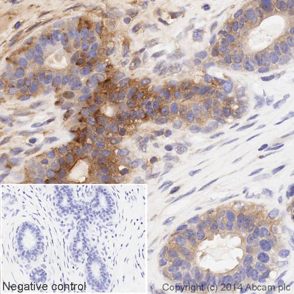 Immunohistochemistry (Formalin/PFA-fixed paraffin-embedded sections) - HRP Anti-MMP14 antibody [EP1264Y] (AB194242)
