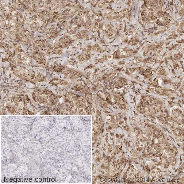 Immunohistochemistry (Formalin/PFA-fixed paraffin-embedded sections) - HRP Anti-MMP9 antibody [EP1255Y] (AB194316)