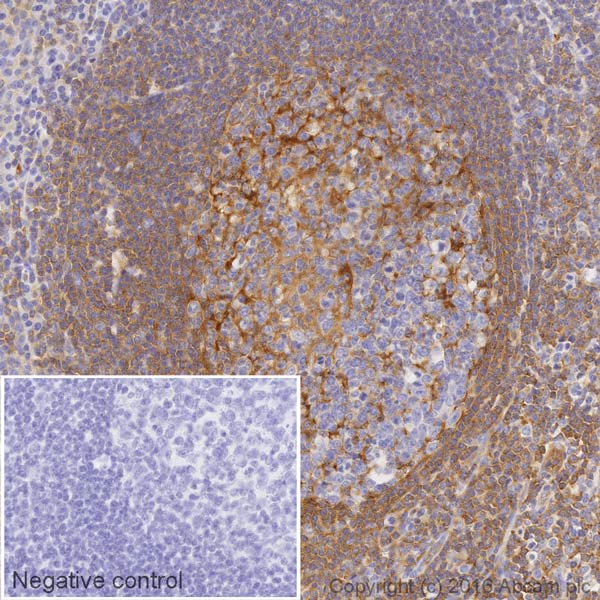 Immunohistochemistry (Formalin/PFA-fixed paraffin-embedded sections) - HRP Anti-Moesin antibody [EP1863Y] (AB207629), expandable thumbnail
