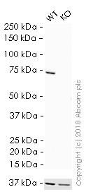 Western blot - HRP Anti-Moesin antibody [EP1863Y] (AB207629), expandable thumbnail
