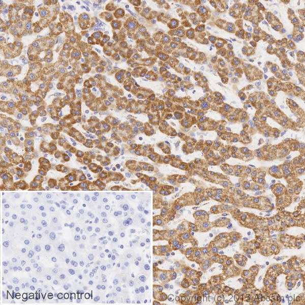 Immunohistochemistry (Formalin/PFA-fixed paraffin-embedded sections) - HRP Anti-MTCO2 antibody [EPR3314] (AB200615)