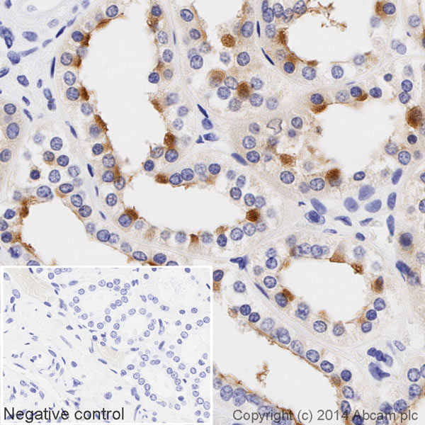 Immunohistochemistry (Formalin/PFA-fixed paraffin-embedded sections) - HRP Anti-MUC1 antibody [EPR1023] (AB195936), expandable thumbnail