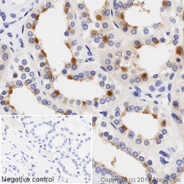 Immunohistochemistry (Formalin/PFA-fixed paraffin-embedded sections) - HRP Anti-MUC1 antibody [EPR1023] (AB195936)