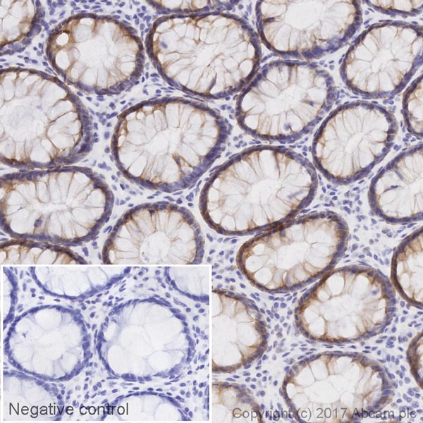Immunohistochemistry (Formalin/PFA-fixed paraffin-embedded sections) - HRP Anti-MUC1 antibody [HMFG1 (aka 1.10.F3)] (AB215778)