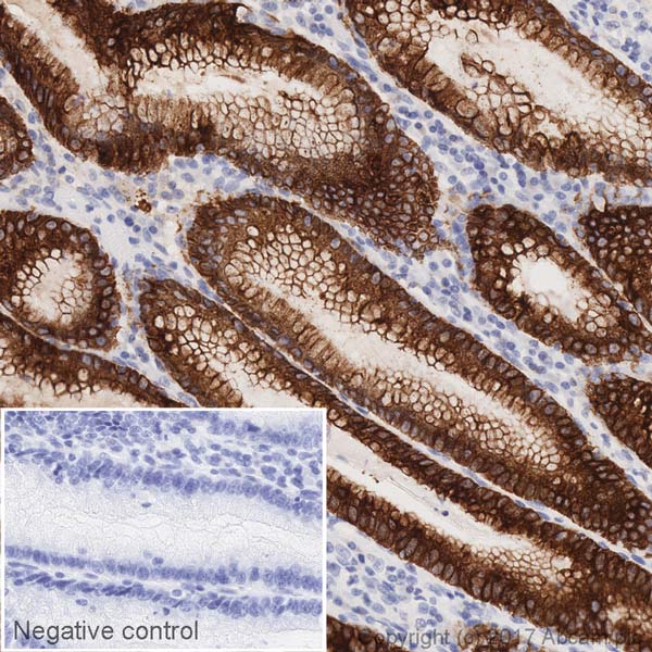 Immunohistochemistry (Formalin/PFA-fixed paraffin-embedded sections) - HRP Anti-Mucin 5AC antibody [EPR16904] (AB218713), expandable thumbnail