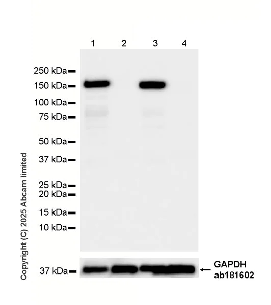 Western blot - HRP Anti-MYBPC3 antibody [EPR25673-58] (AB324295)