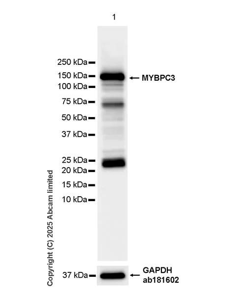 Western blot - HRP Anti-MYBPC3 antibody [EPR25673-58] (AB324295)