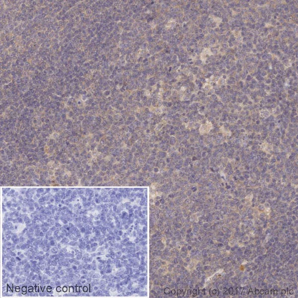 Immunohistochemistry (Formalin/PFA-fixed paraffin-embedded sections) - HRP Anti-MyD88 antibody [EPR590(N)] (AB218705)