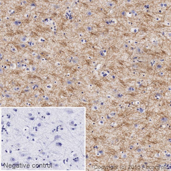 Immunohistochemistry (Formalin/PFA-fixed paraffin-embedded sections) - HRP Anti-Myelin oligodendrocyte glycoprotein antibody [EP4281] - Oligodendrocyte Marker (AB199236)