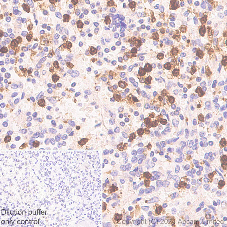 Immunohistochemistry (Formalin/PFA-fixed paraffin-embedded sections) - HRP Anti-Myeloperoxidase antibody [EPR20257] (AB323726)