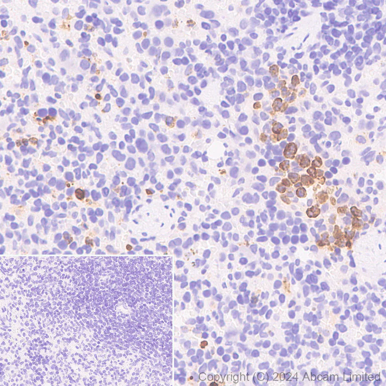 Immunohistochemistry (Formalin/PFA-fixed paraffin-embedded sections) - HRP Anti-Myeloperoxidase antibody [EPR20257] (AB323726)