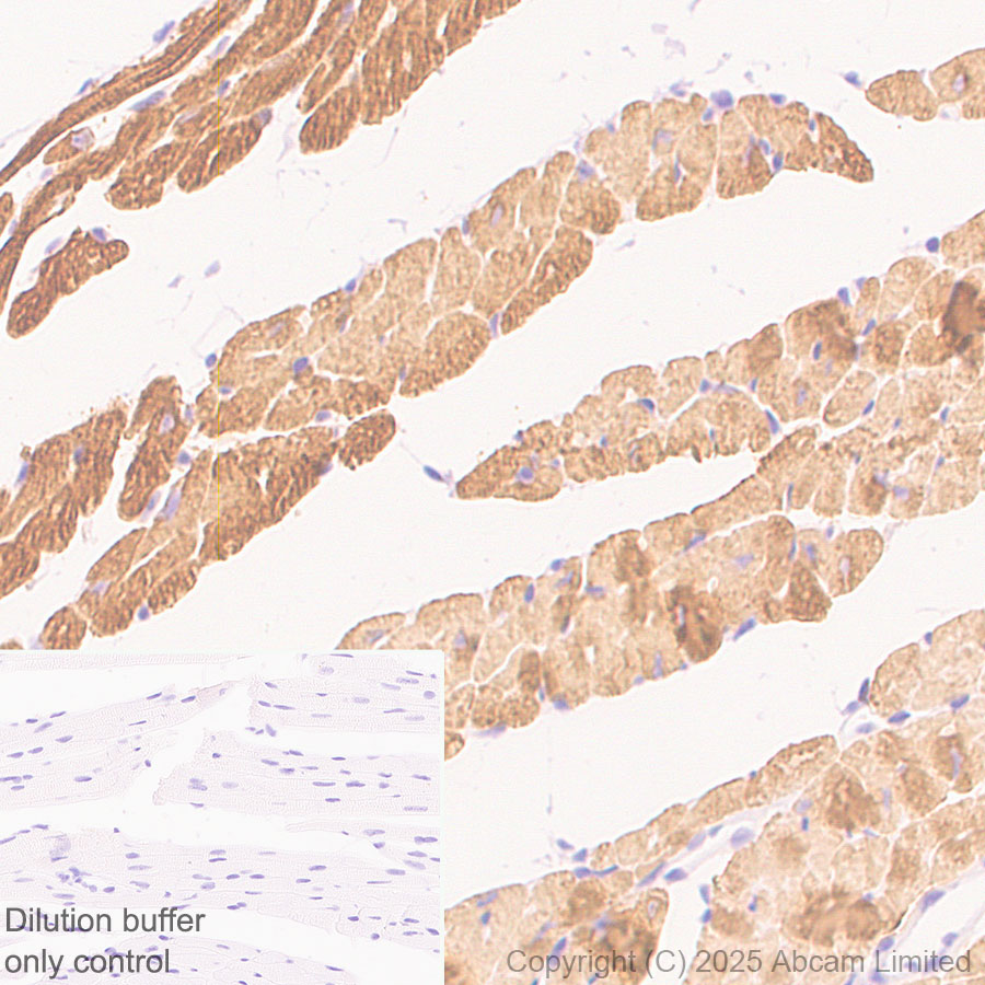 Immunohistochemistry (Formalin/PFA-fixed paraffin-embedded sections) - HRP Anti-Myosin antibody [A4.1025] (AB323782), expandable thumbnail