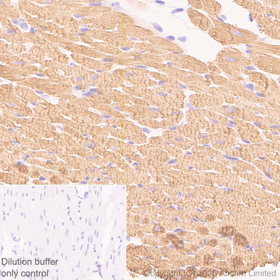 Immunohistochemistry (Formalin/PFA-fixed paraffin-embedded sections) - HRP Anti-Myosin antibody [A4.1025] (AB323782), expandable thumbnail