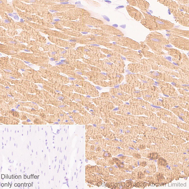 Immunohistochemistry (Formalin/PFA-fixed paraffin-embedded sections) - HRP Anti-Myosin antibody [A4.1025] (AB323782)