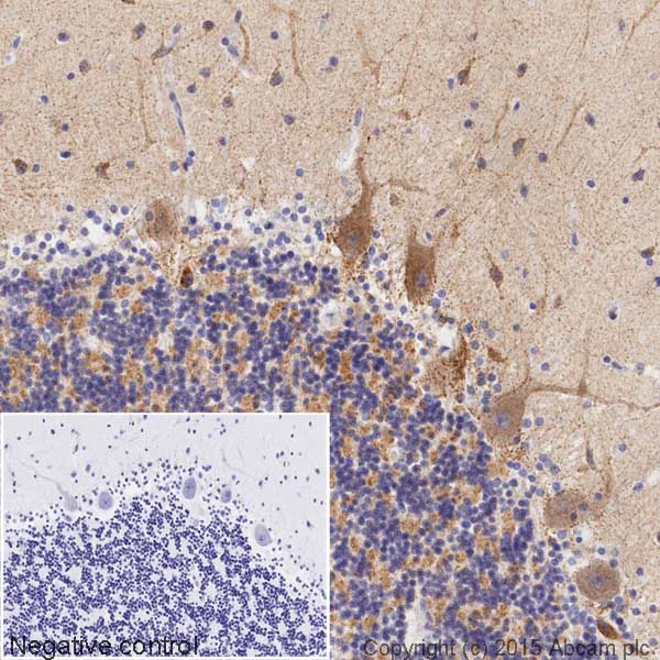 Immunohistochemistry (Formalin/PFA-fixed paraffin-embedded sections) - HRP Anti-NDUFS3 antibody [3F9DD2] (AB197971)